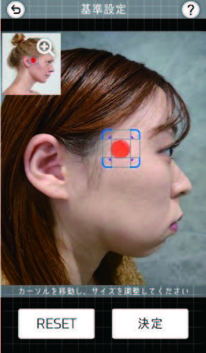Be-line-1-基準設定