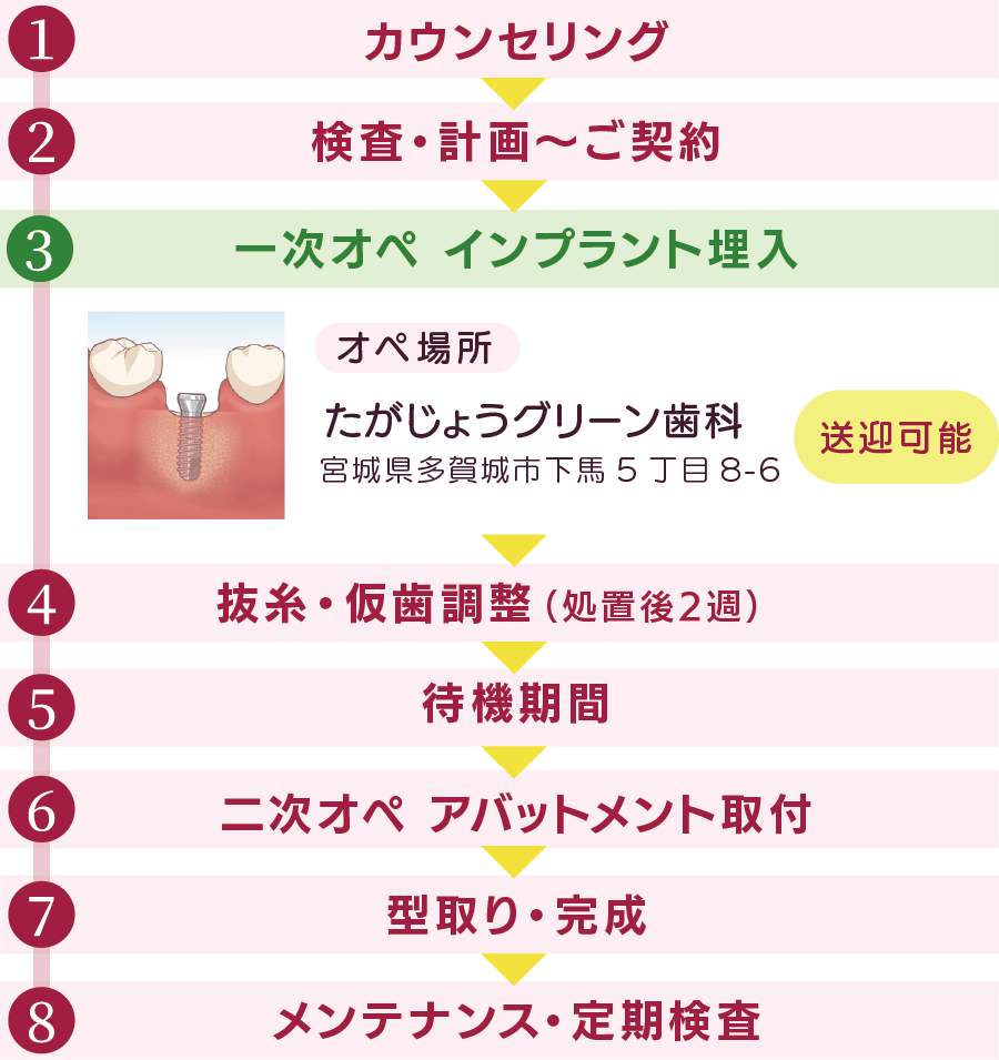 インプラント治療の流れ