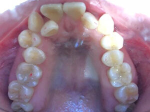 case14-before3