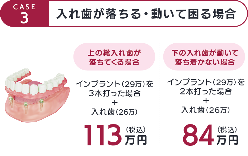 CASE3-入れ歯が落ちる・動いて困る場合