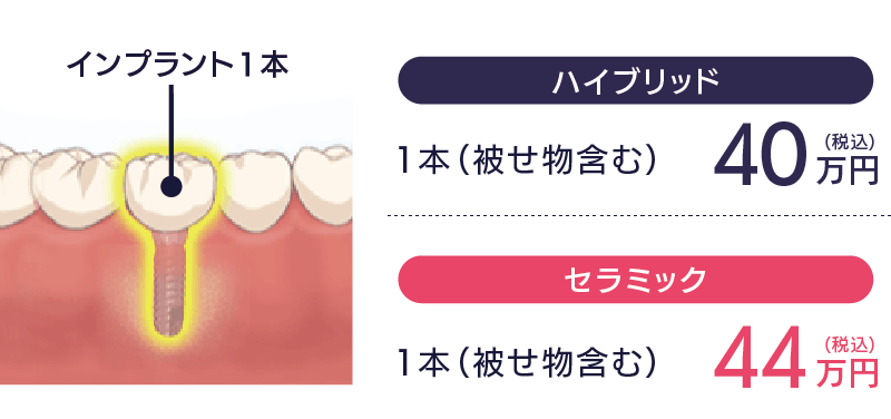 CASE1-歯を1本失った場合-セラミック40万