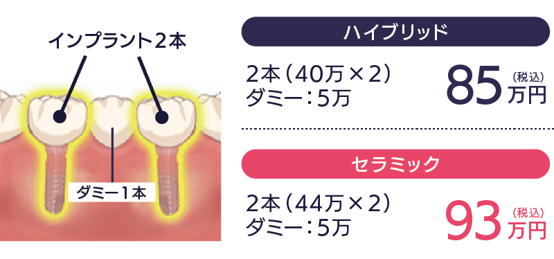 CASE2-歯を3本失った場合-セラミック85万
