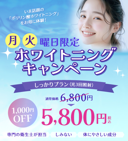 月・火曜日限定ホワイトニングキャンペーン。6,800円が月・火曜日限定で1000円OFFの5,800円